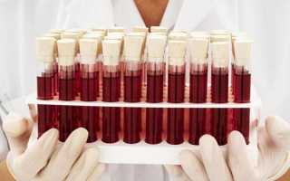 Совместимость групп крови и резус-фактора