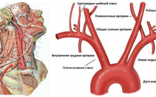 Брахиоцефальных артерий
