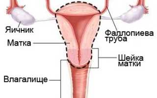 Рак шейки матки; скрининг и профилактика