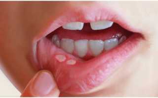 Заболевания полости рта и зубов