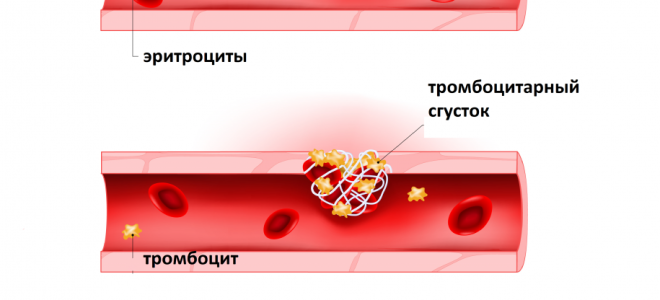 Коагулограмма (скрининг)