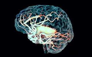 Что такое очаговое изменение вещества мозга дистрофического характера