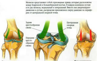 Нестабильность коленного сустава