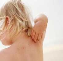 Аллергические дерматозы у детей