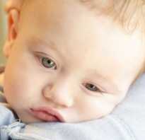 Почему у ребенка при простуде гноятся глаза
