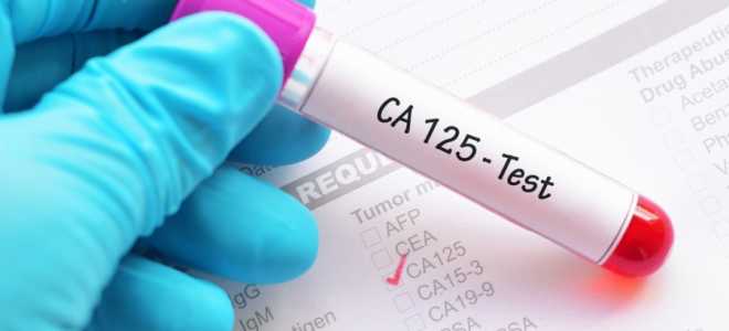 Онкомаркер яичников СА 125