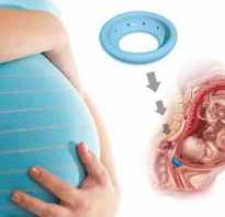 Коррекция ИЦН во время беременности