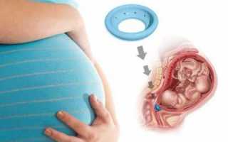 Коррекция ИЦН во время беременности