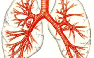 Бронхиальная астма — воспаление бронхов