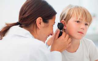 Воспаление среднего уха возникновение и причины проявления диагностика лечение