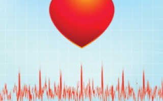 Тахикардия: как уменьшить частоту сердцебиения без помощи врача